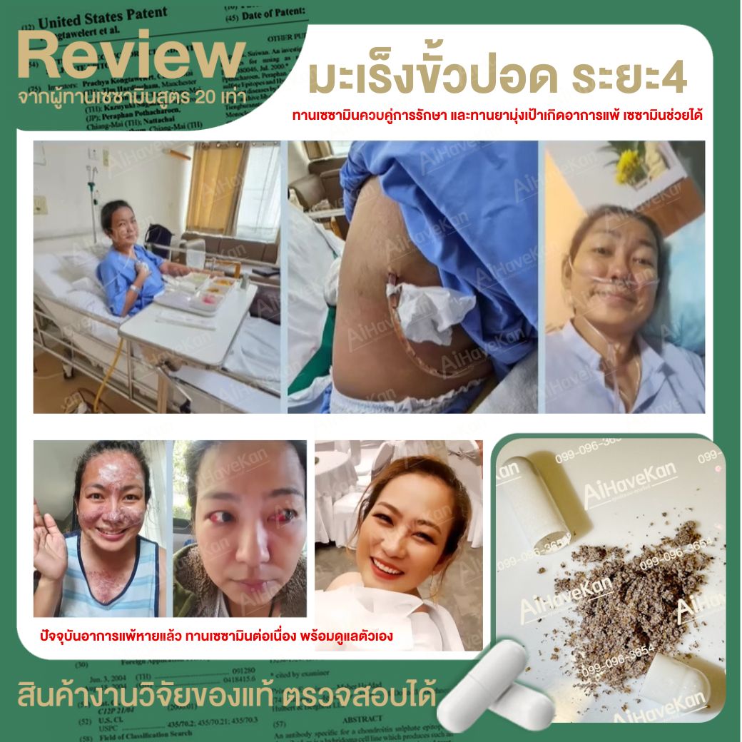 เซซามิน มะเร็ง ขั้วปอด