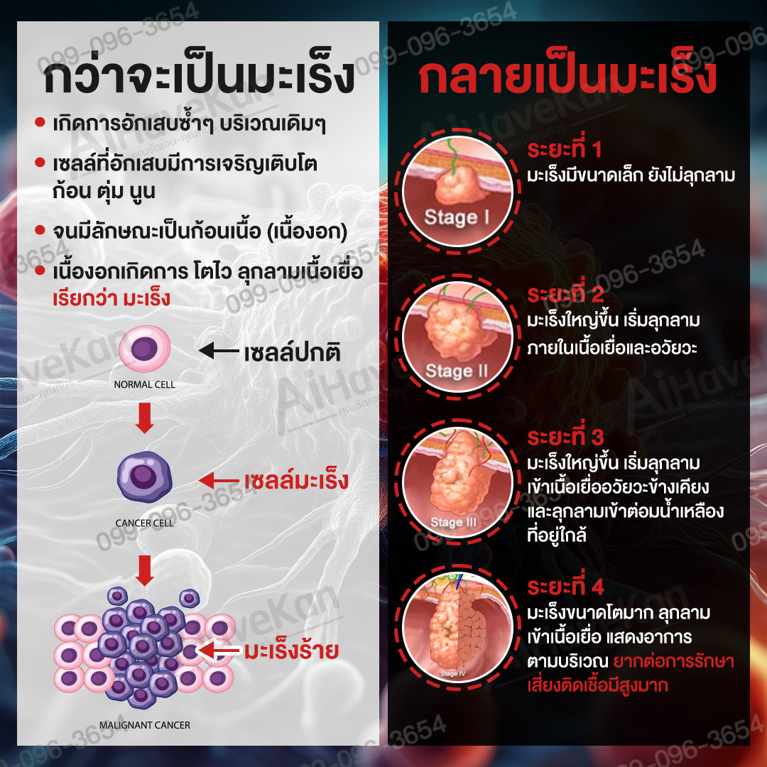 เกิดมะเร็ง-ระยะมะเร็ง